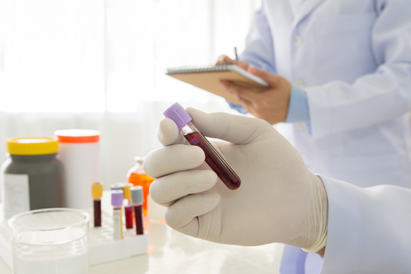 Podstawowe profilaktyczne badania krwi – po co i jak często je wykonywać?